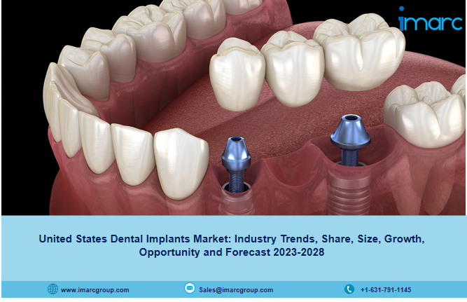 United States Dental Implants Market Size and Growth Analysis