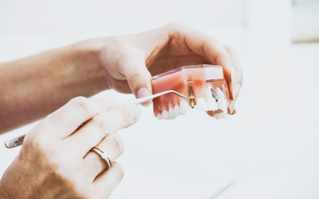 What Should I Do If I Have A Dental Emergency Outside Of Regular Office Hours?